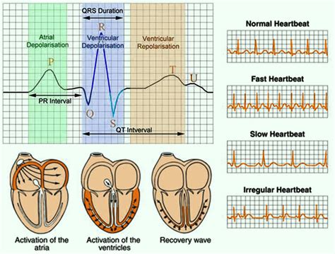 how to read ekg test results|Electrocardiogram (ECG, EKG) Test Results, Interpretation .